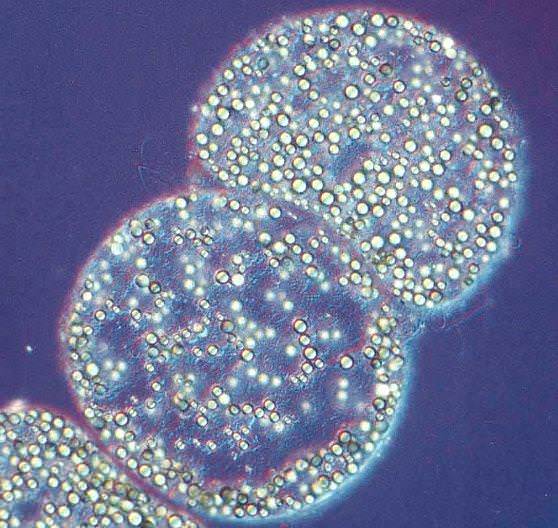 Thiomargarita namibiensis самый большой микроб 